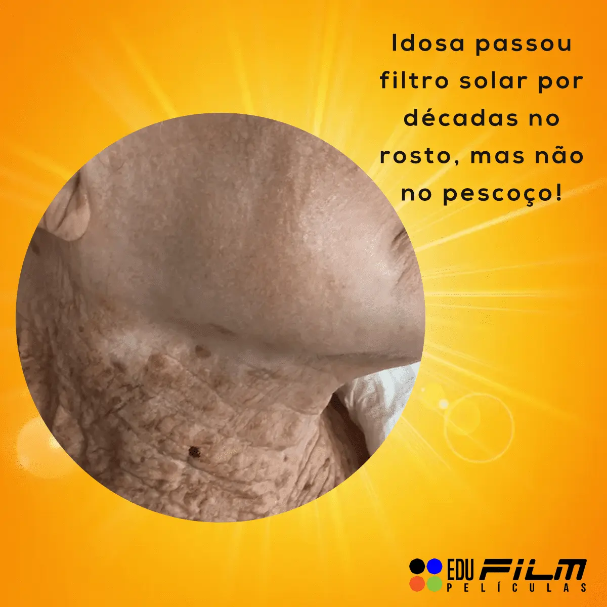 O sol envelhece a pele: Confira a ação do sol na pele